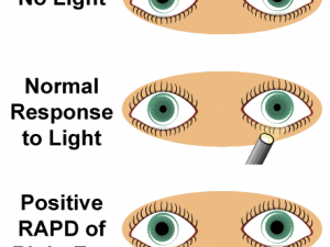 High Eyes PNG Picture